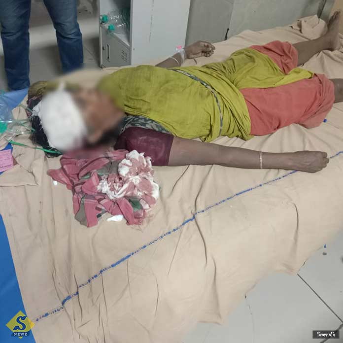 Female BJP worker hacked to death in Nandigram Female BJP worker hacked to death in Nandigram