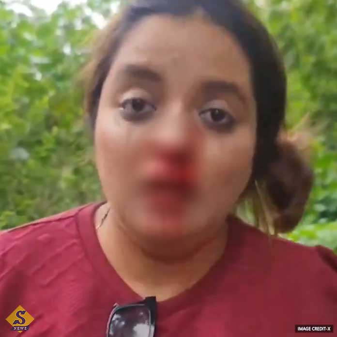 Elderly couple broke womans nose in Pune
