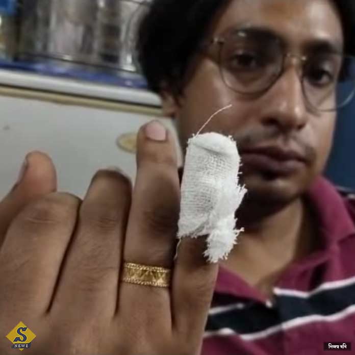 BDO of Habibpur accused of beating doctor