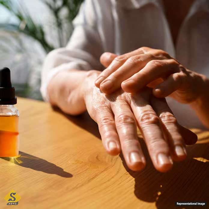 Oil-on-dry-skin-in-winter