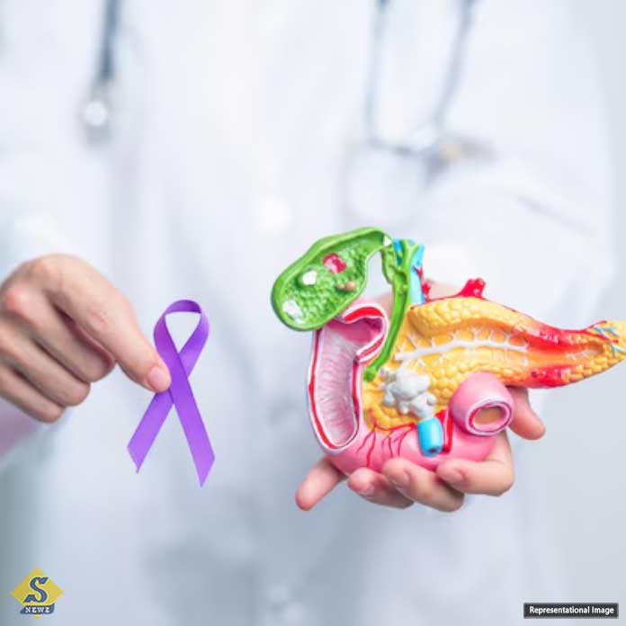 Pancreatic cancer