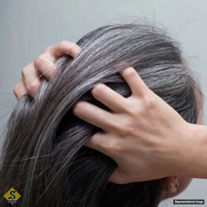 Grey-hair