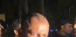 পুলিশের লাঠিতে ভাঙল পা, ঝরল রক্ত, ধুন্ধুমার বিকাশভবন