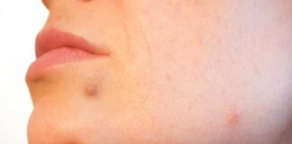 শরীরে চিনির পরিমাণ অতিরিক্ত ?