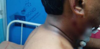 মালদায় এলোপাথাড়ি গুলিতে আহত ব্যবসায়ী