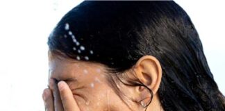 বর্ষায় তৈলাক্ত ত্বকের সমস্যা