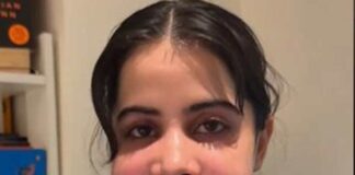 ঠোঁট ফুলে বেহাল উরফি