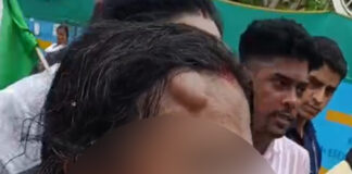 লাঠির আঘাতে ফুলেছে কপাল, হাসপাতালে অভয়ার মা, বাবাও