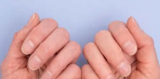 নখই বলবে হার্ট অ্যাটাকের লক্ষণ