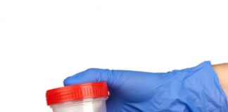 প্রস্রাব কত ! প্রয়োজনে নজরে