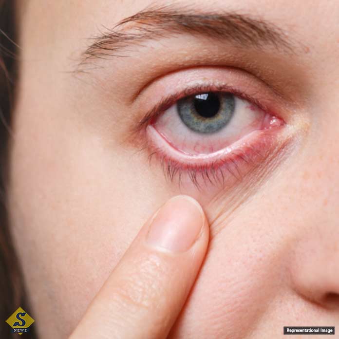 To-avoid-eye-infections-during-the-monsoon