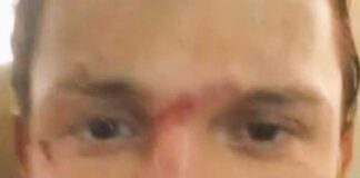 শুটিংয়ে আহত ‘স্পাইডার ম্যান’