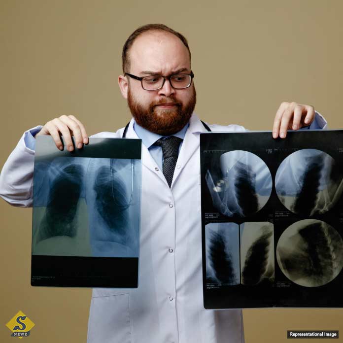 Damaged-lungs-due-to-various-reasons