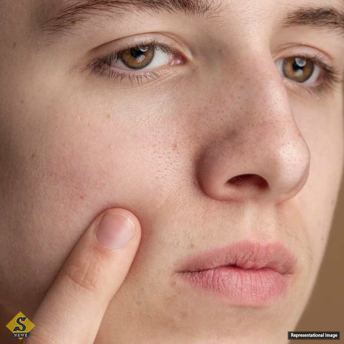 Solutions-for-dry-skin