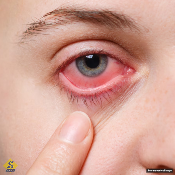 The-risk-of-corneal-ulcers-increases-in-winter.