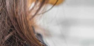 শীতে খুশকি রোধে