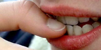 নখ কামড়ানোর কারণে শিশুর রোগ