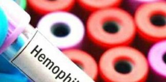 হিমোফিলিয়া : লক্ষণ ও প্রতিকার